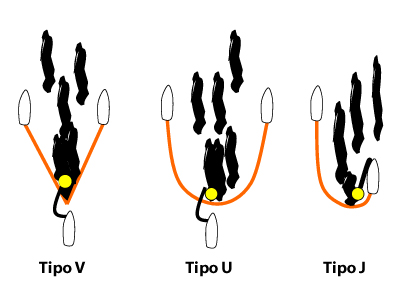 Configuraciones de barreras remolcadas en V, U y J